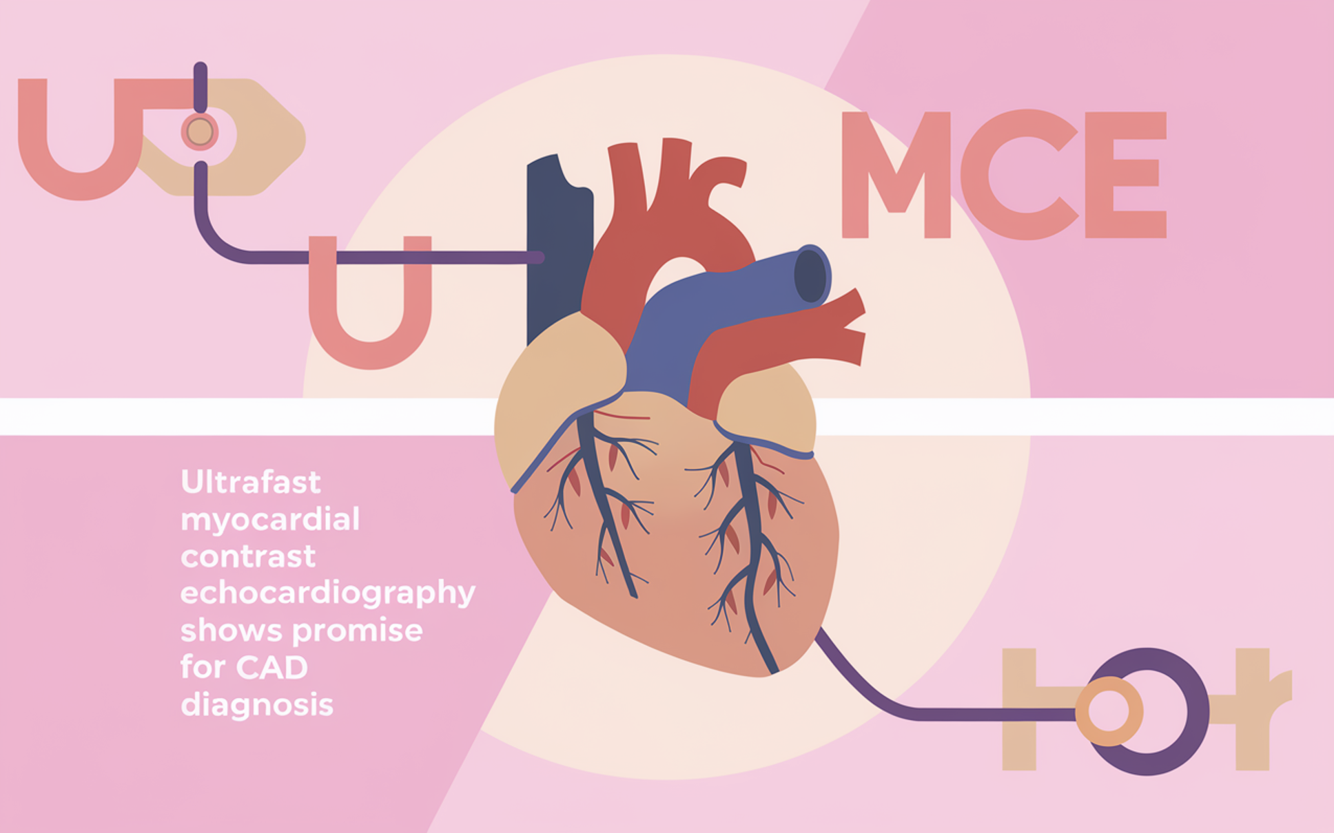 Ultrafast Myocardial Contrast Echocardiography Shows Promise for CAD Diagnosis